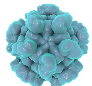 Hepatitis-E-Virus-assoziiertes Guillain-Barré-Syndrom