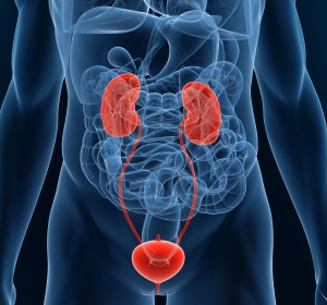 Diagnostik und Therapie der Urolithiasis