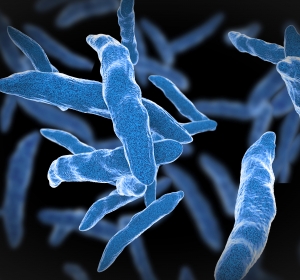 Tuberkulose: Diagnostik und Therapie