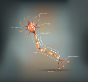 Diagnose und Therapie der chronischen inflammatorischen demyelinisierenden Polyneuropathie