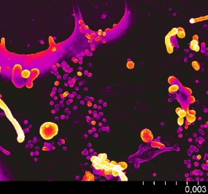 Versteckte HI-Viren im Visier