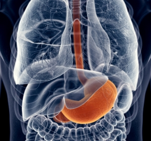 Refluxkrankheit: Neues Therapieverfahren LINX 