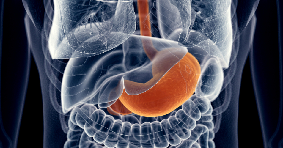 Refluxkrankheit: Neues Therapieverfahren LINX