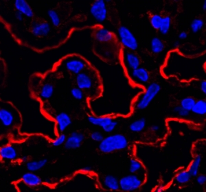 Alterung und Verjüngung von Nischen beeinflussen Stammzellen