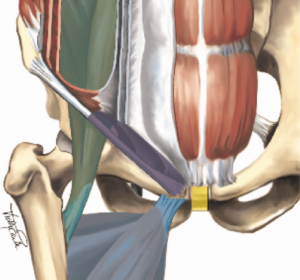 Diagnostik und Therapie der „Sportlerleiste“