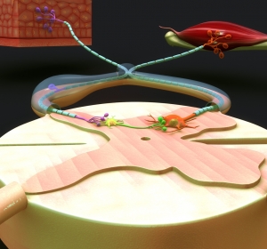 Amyotrophe Lateralsklerose, ein vielschichtiges neurodegeneratives Syndrom