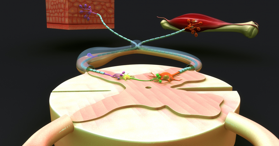 Amyotrophe Lateralsklerose, ein vielschichtiges neurodegeneratives Syndrom