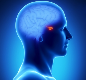 Akromegalie: „Die Diagnosestellung ist eine große Herausforderung“