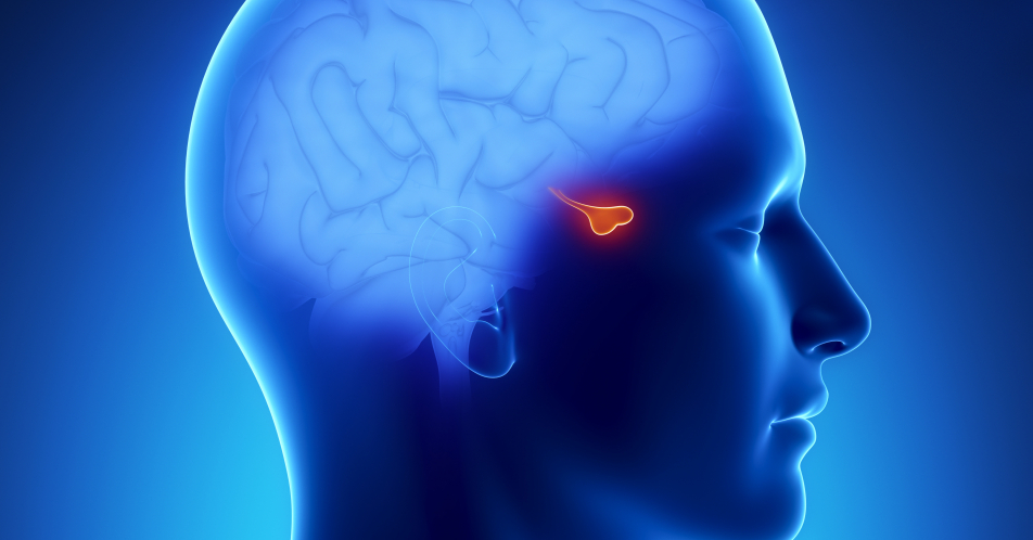 Akromegalie: „Die Diagnosestellung ist eine große Herausforderung“