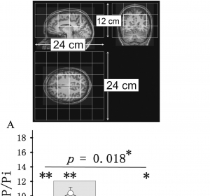 Gestörte Hirn-Energiegewinnung bei Übergewicht