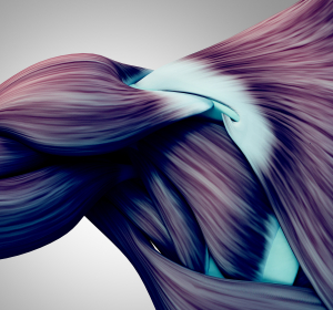 Proximale Muskelschwäche + Hyper-CK-Ämie = „Red flags“ für Morbus Pompe