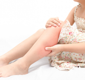 Schmerzerkrankungen mit Manifestation am Bewegungsapparat bei Kindern und Jugendlichen