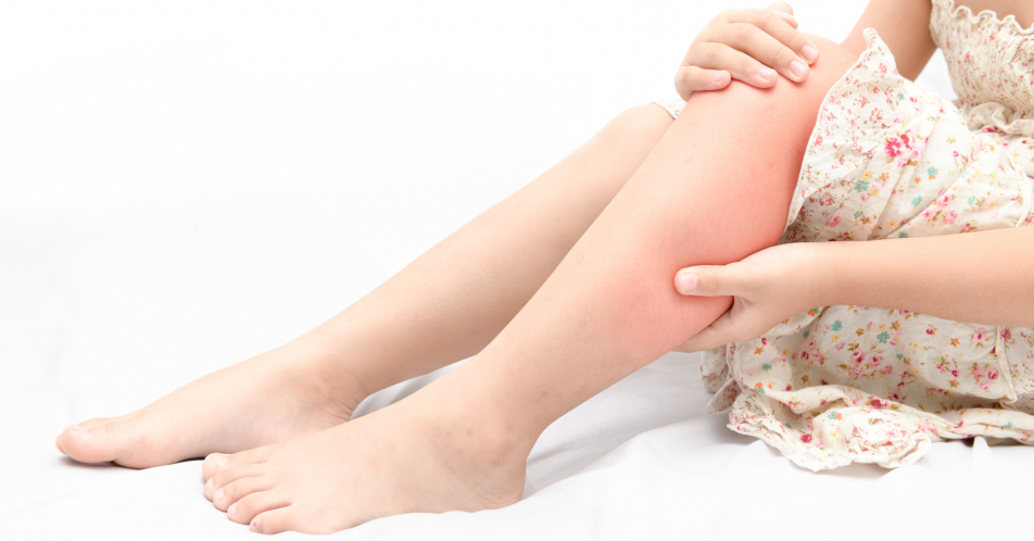 Schmerzerkrankungen mit Manifestation am Bewegungsapparat bei Kindern und Jugendlichen