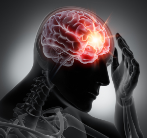 Migräne: Symptombekämpfung mit Nasenspray 