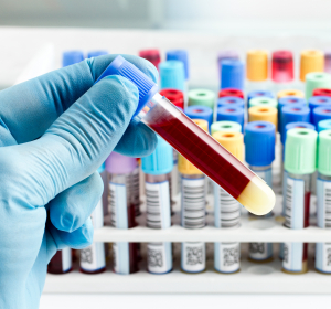 Fleischallergie: Diagnostik mit Bluttest 