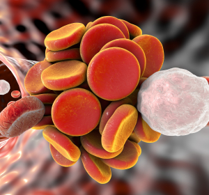 Behçet-Syndrom: MR-Venographie zur Diagnostik einer chronischen Thrombose 