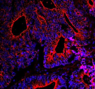 Darmspiegelung schon ab 50 – vor allem für Männer